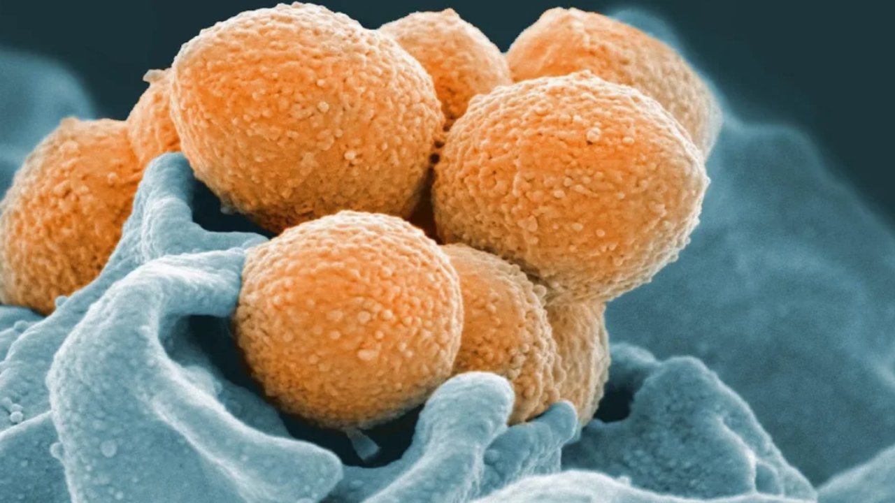 Japonya’da Strep A alarmı: Hızla yayılıyor, sebebi bilinmiyor…