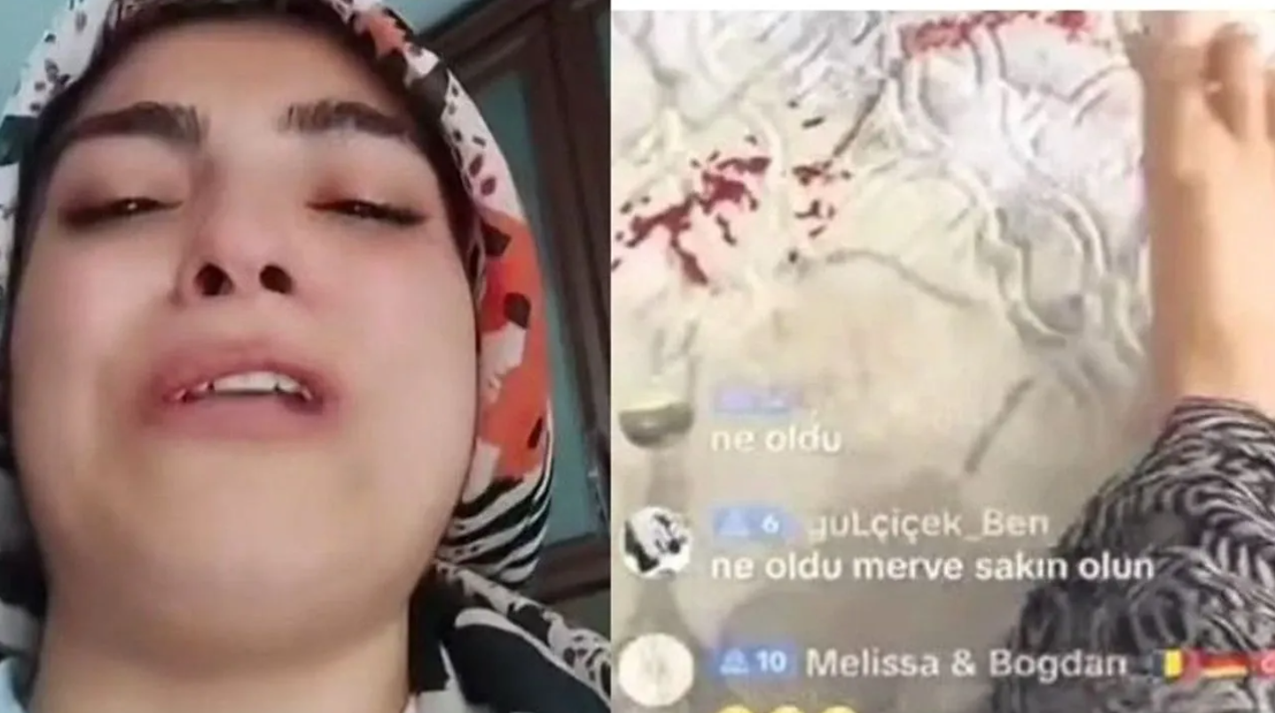 Bursa’da Çocuğu Yaralıyken Canlı Yayın Açan Anne Tutuklandı! Bursa’da Çocuğu Yaralıyken Canlı Yayın Açan Anne Tutuklandı!