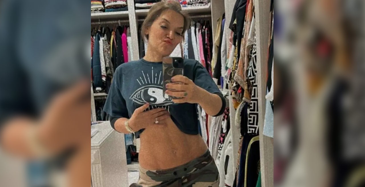 Demet Akalın, verdiği kiloları göbeğini açıp böyle gösterdi Demet Akalın, verdiği kiloları göbeğini açıp böyle gösterdi