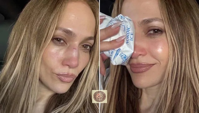 Jennifer Lopez’e dikiş şoku! AMAs sunumu öncesi talihsiz kaza Jennifer Lopez’e dikiş şoku! AMAs sunumu öncesi talihsiz kaza